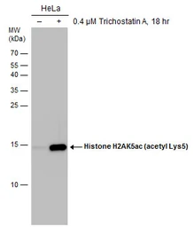 Anti-Histone H2AK5ac (acetyl Lys5) antibody [GT1262] used in Western Blot (WB). GTX633388